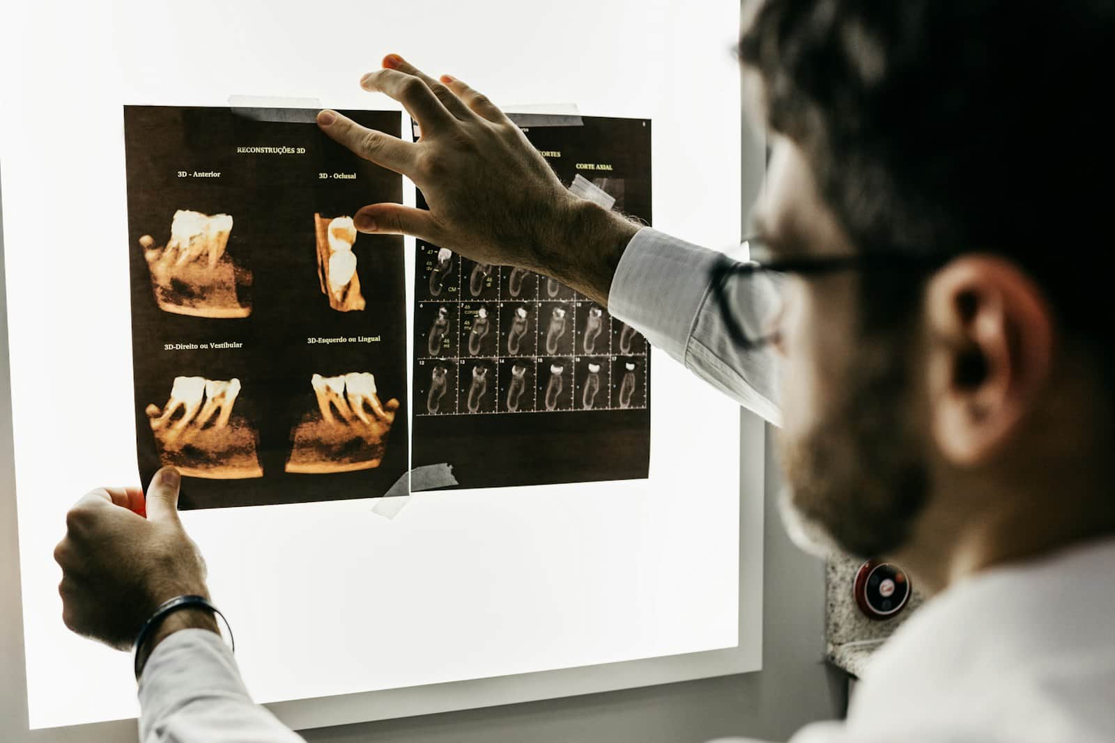 Dentist examining dental X-ray images on a lightbox before planning treatment