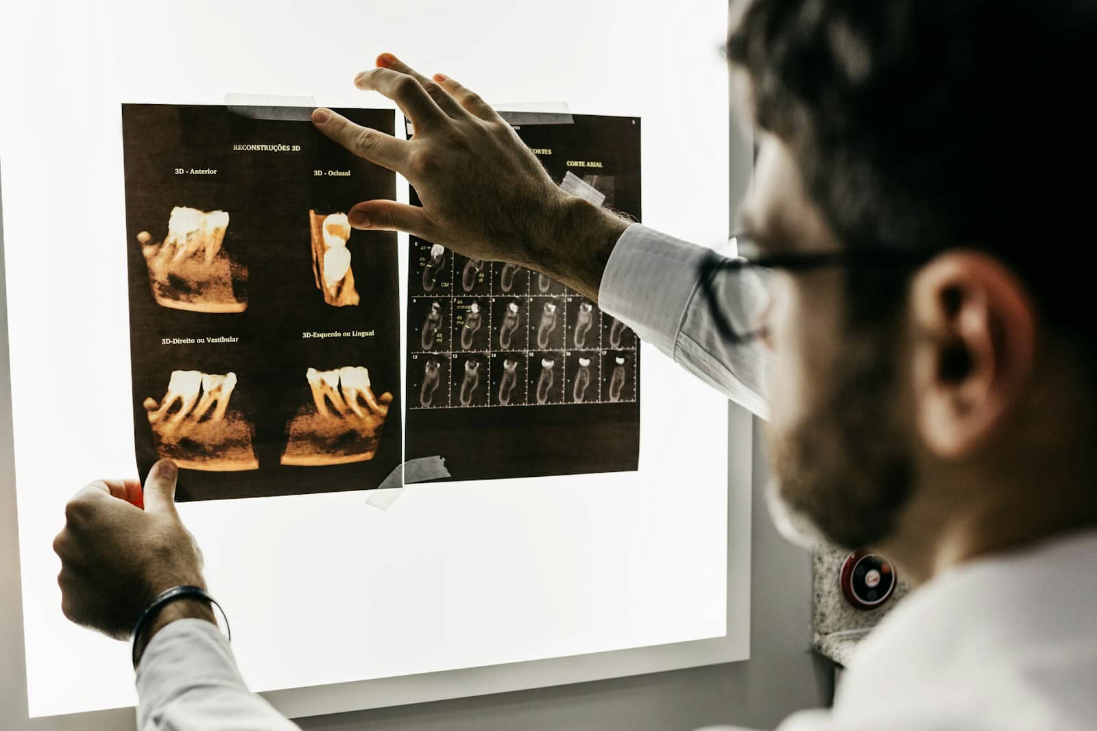Dentist examining dental X-ray images on a lightbox before planning treatment